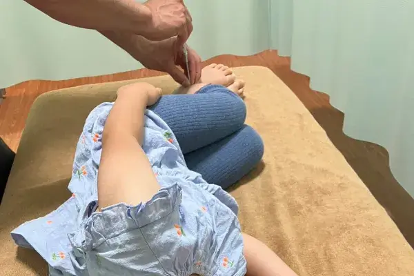 足の鍼治療